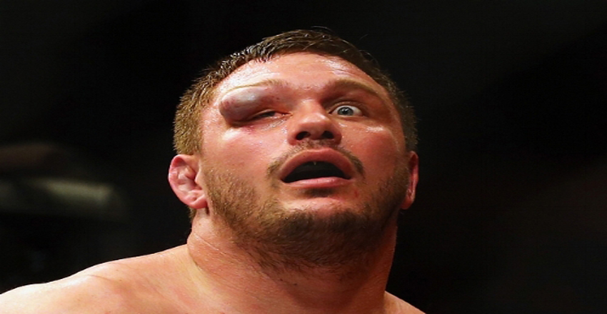 Worst UFC Injuries